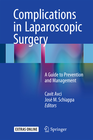 neues Buch – Cavit Avci – Complications in Laparoscopic Surgery