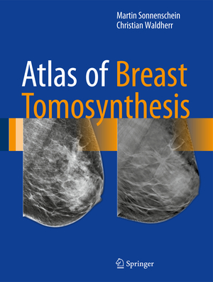 ISBN 9783319215655: Atlas of Breast Tomosynthesis - Imaging Findings and Image-Guided Interventions