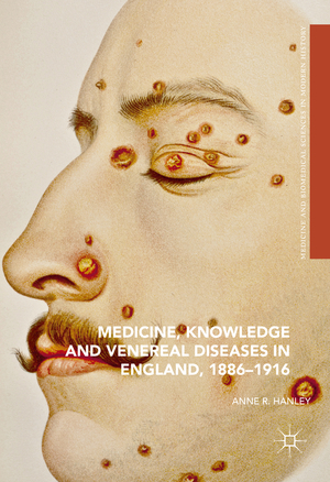 ISBN 9783319324548: Medicine, Knowledge and Venereal Diseases in England, 1886-1916