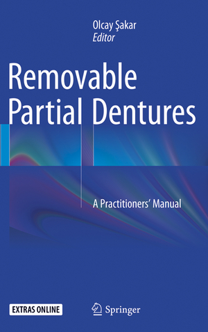 ISBN 9783319371474: Removable Partial Dentures – A Practitioners’ Manual