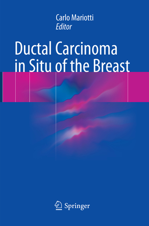 ISBN 9783319861661: Ductal Carcinoma in Situ of the Breast