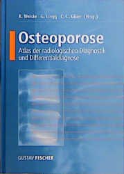 Gerwin Lingg (Herausgeber), Claus-C. Gler (Herausgeber) - Osteoporose: Atlas der radiologischen Diagnostik und Differentialdiagnose Gerwin Lingg Claus-C. Gler Knochenbild Laborparameter Strukturanalyse mit CT nuklearmedizinische Diagnostik Knochendensitometrie Pathogenese Pathophysiologie Knochenhistologie Knochenbiopsie Toxikosen Differentialdiagnostik Atlanten