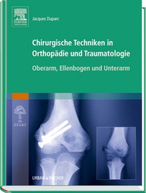 gebrauchtes Buch – Jacques Duparc Tomas Epeldegui Torre Nikolaus Wülker Tomas Epeldegui Torre – Chirurgische Techniken in Orthopädie und Traumatologie Band 4 Oberarm, Ellenbogen und Unterarm [Gebundene Ausgabe] Jacques Duparc Operative Zugänge zu Oberarm, Unterarm und Ellenbogen - Arthroskopie d