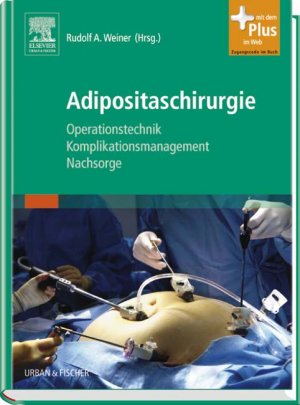 ISBN 9783437230257: Adipositaschirurgie - Operationstechnik - Komplikationsmanagement - Nachsorge - mit Zugang zum Elsevier-Portal