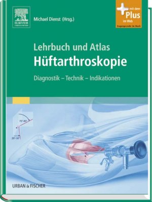 ISBN 9783437246104: Lehrbuch und Atlas Hüftarthroskopie: Diagnostik - Technik - Indikationen - mit Zugang zum Elsevier-Portal: Diagnostik - Technik - Indikationen. Mit dem Plus im Web. Zugangscode im Buch