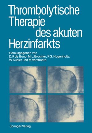 gebrauchtes Buch – D. P. de Bono – Thrombolytische Therapie des akuten Herzinfarkts