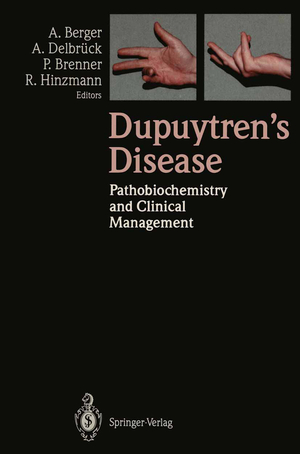 ISBN 9783540572398: Dupuytren’s Disease – Pathobiochemistry and Clinical Management