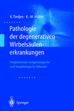 ISBN 9783540677741: Pathologie der degenerativen Wirbelsäulenerkrankungen - Vergleichende röntgenologische und morphologische Befunde