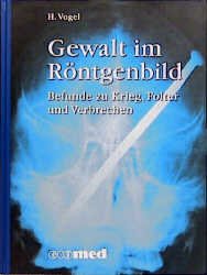 ISBN 9783609628707: Gewalt im Röntgenbild: Befunde zu Krieg, Folter und Verbrechen (ecomed Medizin & Biowissenschaften) Vogel, H