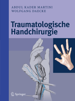 ISBN 9783642009877: Traumatologische Handchirurgie