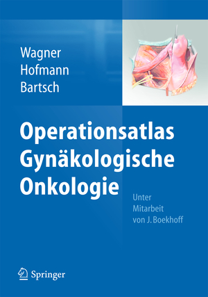 ISBN 9783642351273: Operationsatlas gynäkologische Onkologie., mit 10 Tabellen.