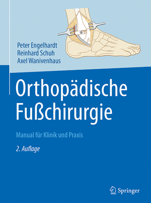gebrauchtes Buch – Engelhardt, Peter; Schuh – Orthopädische Fußchirurgie: Manual für Klinik und Praxis