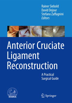 ISBN 9783642453489: Anterior Cruciate Ligament Reconstruction – A Practical Surgical Guide