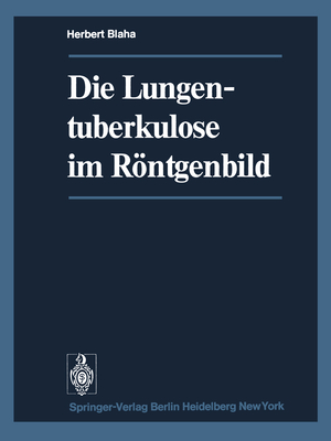 ISBN 9783642491801: Die Lungentuberkulose im Röntgenbild