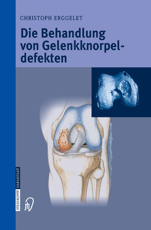 ISBN 9783642621697: Die Behandlung von Gelenkknorpeldefekten (German Edition)