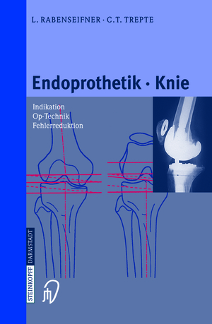 ISBN 9783642633133: Endoprothetik Knie