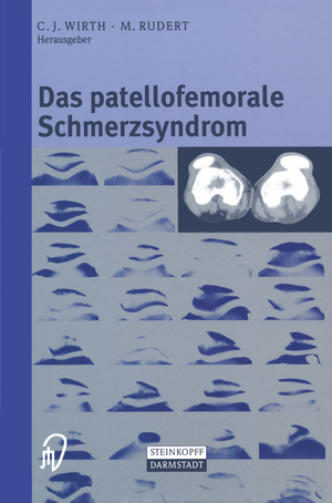 ISBN 9783642633348: Das patellofemorale Schmerzsyndrom