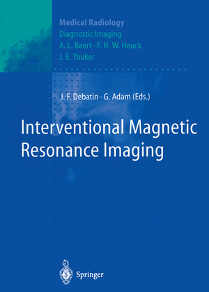 neues Buch – Gerhard Adam – Interventional Magnetic Resonance Imaging