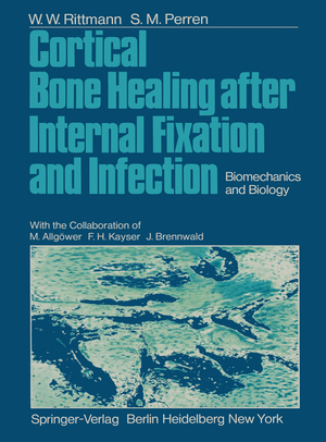 ISBN 9783642659799: Cortical Bone Healing after Internal Fixation and Infection – Biomechanics and Biology