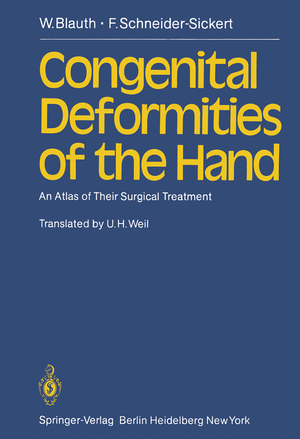 neues Buch – W. Blauth – Congenital Deformities of the Hand