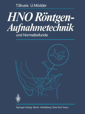 ISBN 9783642692406: HNO Röntgen-Aufnahmetechnik und Normalbefunde