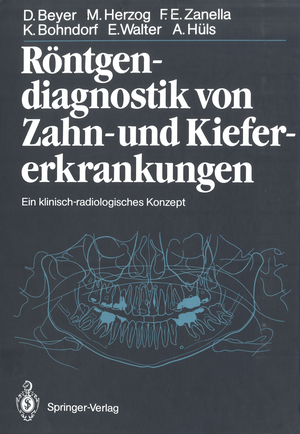 ISBN 9783642710643: Röntgendiagnostik von Zahn- und Kiefererkrankungen - Ein klinisch-radiologisches Konzept