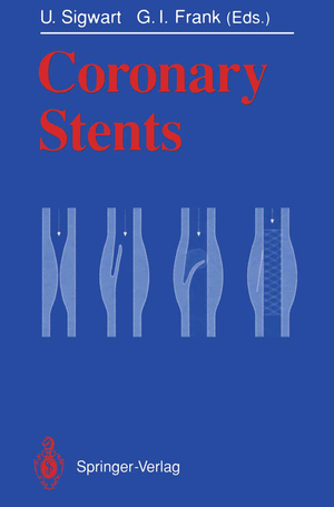 ISBN 9783642769269: Coronary Stents