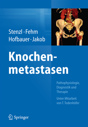 ISBN 9783662434703: Knochenmetastasen - Pathophysiologie, Diagnostik und Therapie - Unter Mitarbeit von T. Todenhöfer