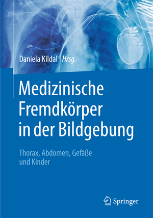 ISBN 9783662472958: Medizinische Fremdkörper in der Bildgebung - Thorax, Abdomen, Gefäße und Kinder