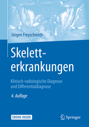 ISBN 9783662481363: Skeletterkrankungen – Klinisch-radiologische Diagnose und Differentialdiagnose