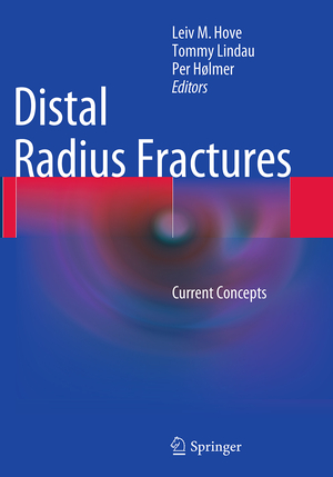 ISBN 9783662512630: Distal Radius Fractures – Current Concepts