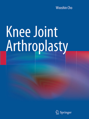 ISBN 9783662513545: Knee Joint Arthroplasty