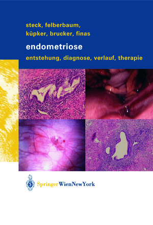 ISBN 9783709171967: Endometriose – Entstehung, Diagnose, Verlauf und Therapie