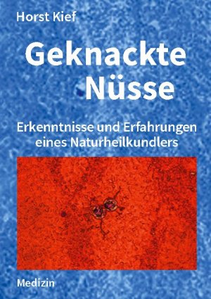 ISBN 9783754302163: Geknackte Nüsse – Erkenntnisse und Erfahrungen eines Naturheilkundlers