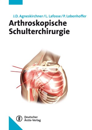 Jens Agneskirchner (Herausgeber), Laurent Lafosse (Herausgeber), P. Lobenhoffer (Herausgeber) - Arthroskopische Schulterchirurgie