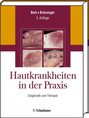 ISBN 9783794523214: Hautkrankheiten in der Praxis - Diagnostik und Therapie