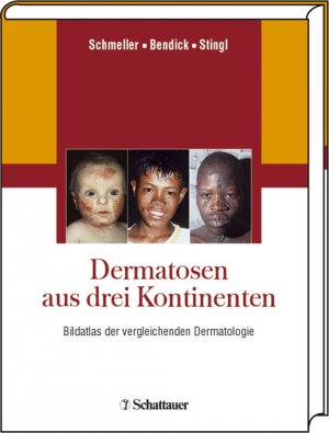 ISBN 9783794523399: Dermatosen aus drei Kontinenten: Bildatlas der vergleichenden Dermatologie Schmeller, Wilfried; Bendick, Christoph and Stingl, Peter