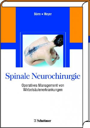 ISBN 9783794525775: Spinale Neurochirurgie: Operatives Management von Wirbelsäulenerkrankungen [Gebundene Ausgabe] Börm, Wolfgang und Meyer, Frerk