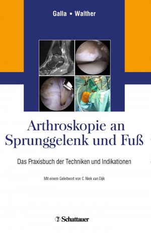 ISBN 9783794529674: Arthroskopie an Sprunggelenk und Fuß – Das Praxisbuch der Techniken und Indikationen