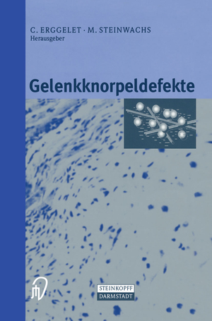 ISBN 9783798512658: Gelenkknorpeldefekte - Neue Behandlungskonzepte -