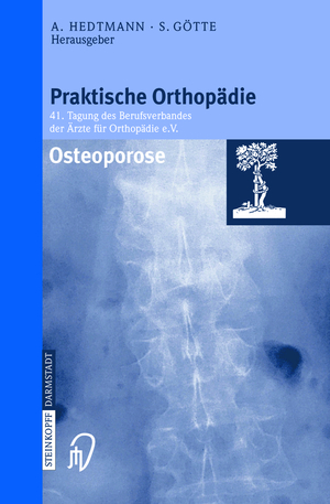 ISBN 9783798513006: Osteoporose