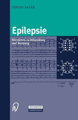 ISBN 9783798513570: Epilepsie - Nützliches zu Behandlung und Beratung