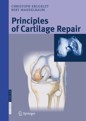 ISBN 9783798515901: Principles of Cartilage Repair