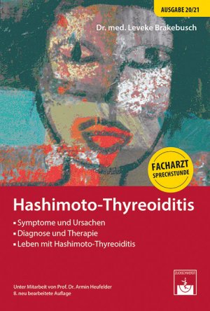 ISBN 9783863713003: Hashimoto-Thyreoiditis - Facharzt-Sprechstunde