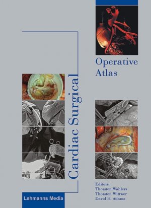 ISBN 9783865412201: Cardiac Surgical Operative Atlas