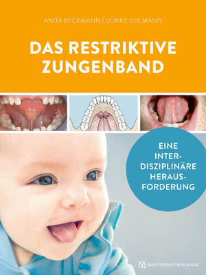 neues Buch – Ulrike Uhlmann – Das restriktive Zungenband