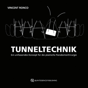 ISBN 9783868677188: Tunneltechnik | Ein umfassendes Konzept für die plastische Parodontalchirurgie | Vincent Ronco | Buch | 304 S. | Deutsch | 2024 | QUINTESSENZ Verlags-GmbH | EAN 9783868677188