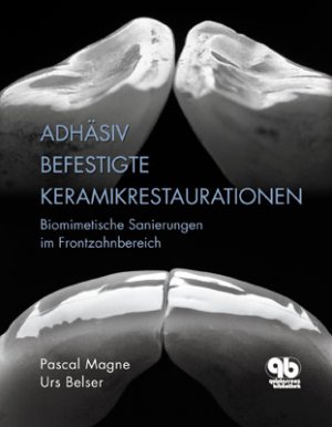 ISBN 9783876523682: Adhäsiv befestigte Keramikrestaurationen im Frontzahnbereich – Biomimetische Sanierungen im Frontzahnbereich