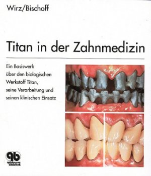 gebrauchtes Buch – Jakob Wirz – Titan in der Zahnmedizin : Ein Basiswerk über den biologischen Werkstoff Titan, seine Verarbeitung und klin