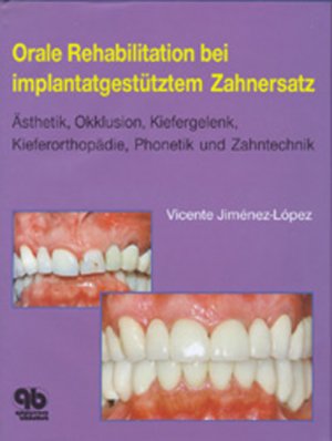 ISBN 9783876525730: Orale Rehabilitation bei implantatgestütztem Zahnersatz - Ästhetik, Okklusion, Kiefergelenk, Kieferorthopädie, Phonetik und Zahntechnik